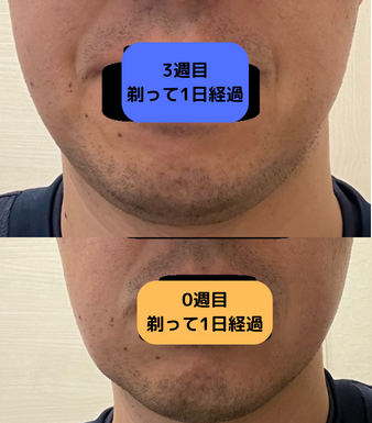 ケノン　比較